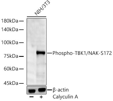 Phospho-TBK1/NAK-S172 Rabbit mAb