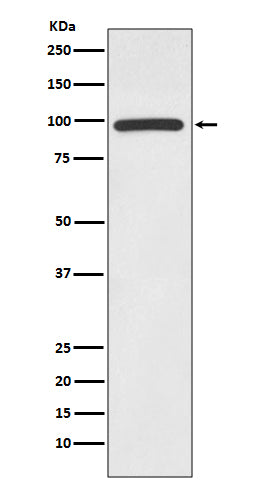HMGCR Rabbit Polyclonal Antibody