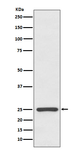 Human kappa Light Chain Rabbit Polyclonal Antibody