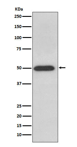 ATPB Rabbit Polyclonal Antibody