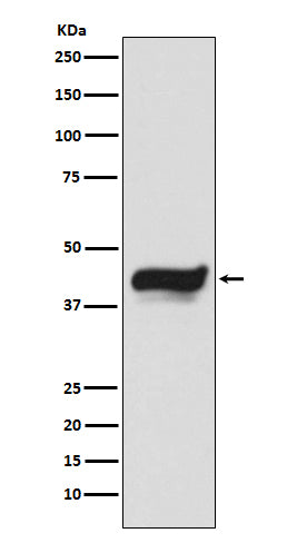 IKB epsilon Rabbit Polyclonal Antibody
