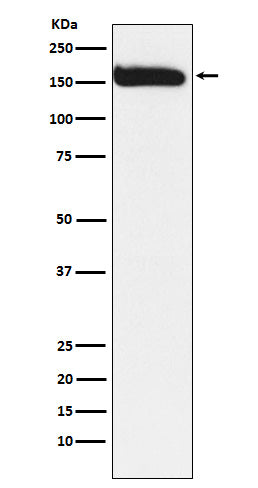KAT13A Rabbit Polyclonal Antibody