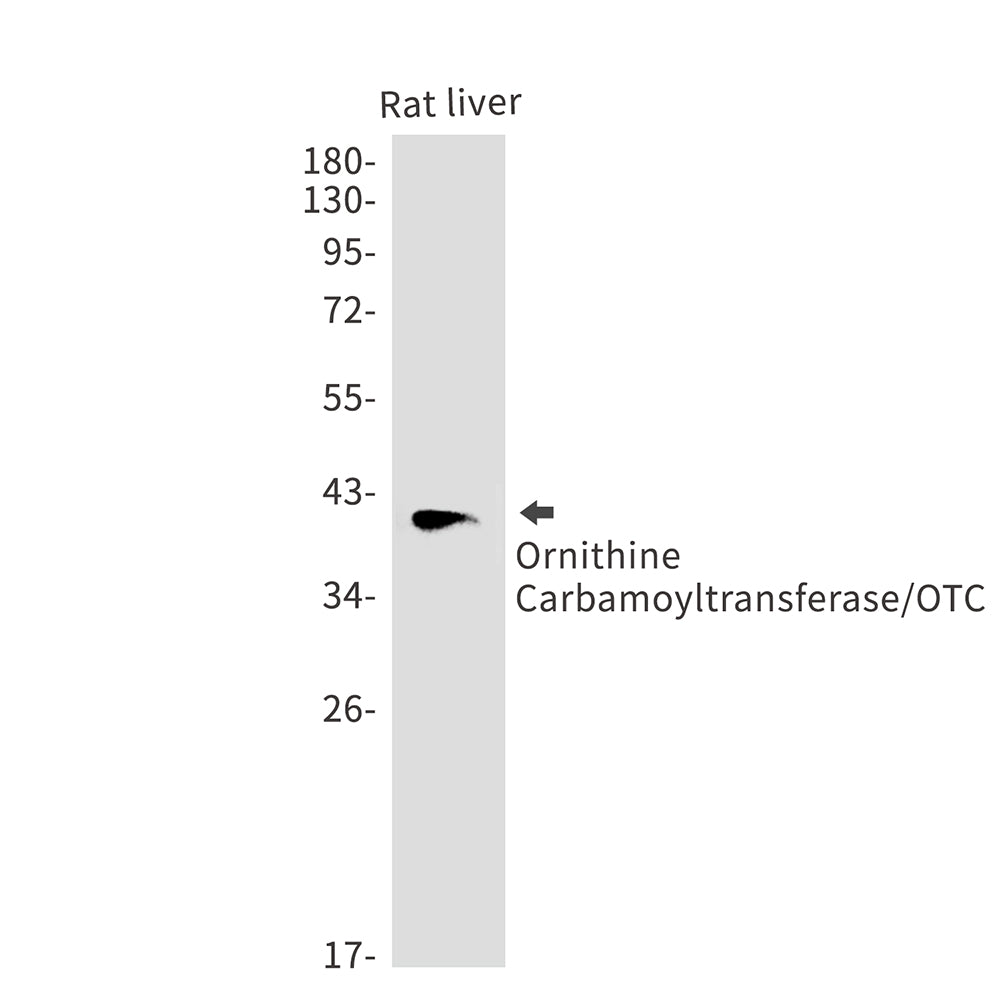 OTC Rabbit Polyclonal Antibody