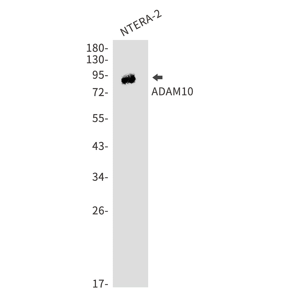 ADAM10 Rabbit Polyclonal Antibody