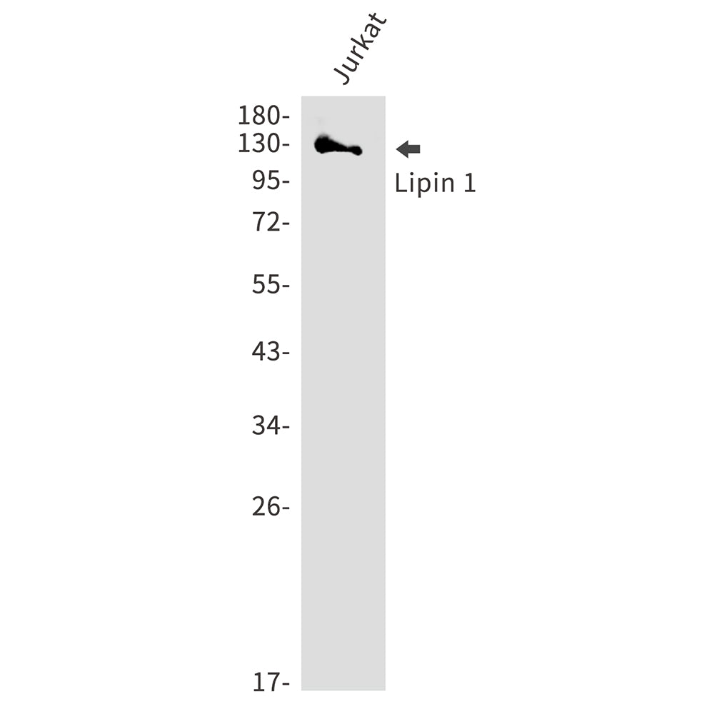 Lipin 1 Rabbit Polyclonal Antibody