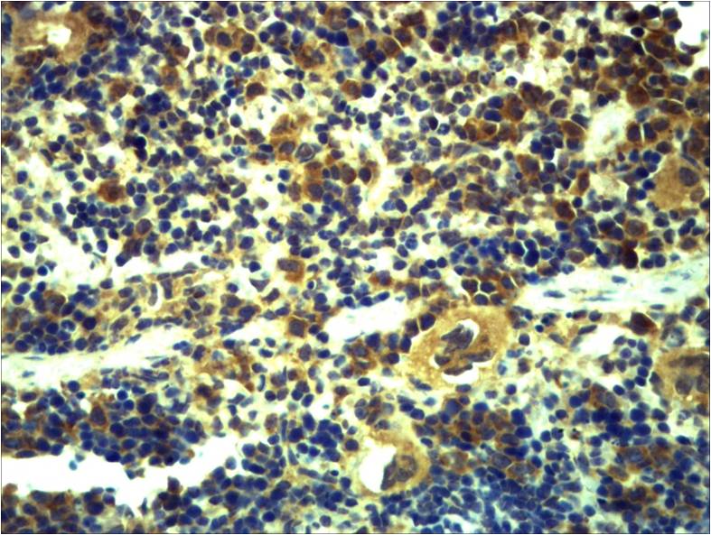 Toll-Like Receptor 6 Rabbit Polyclonal Antibody