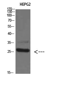 Tryptase delta Rabbit Polyclonal Antibody