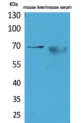 alpha 1 Fetoprotein Rabbit Polyclonal Antibody