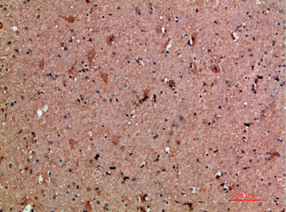 NNT1 Rabbit Polyclonal Antibody