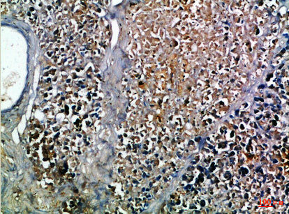 Insulin Rabbit Polyclonal Antibody