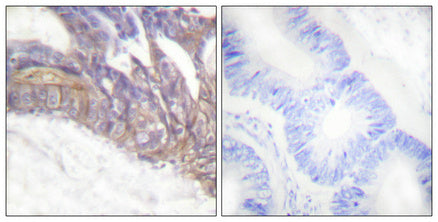 Phospho-LAT (Tyr191) Rabbit Polyclonal Antibody