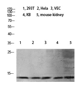 Mono-Methyl-Histone H4 (K21) Rabbit Polyclonal Antibody