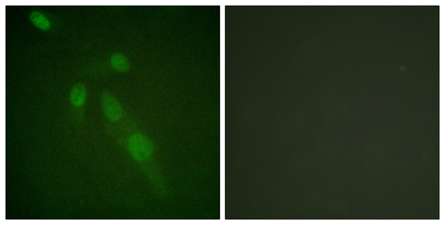 Acetyl Lys proteins Rabbit Polyclonal Antibody