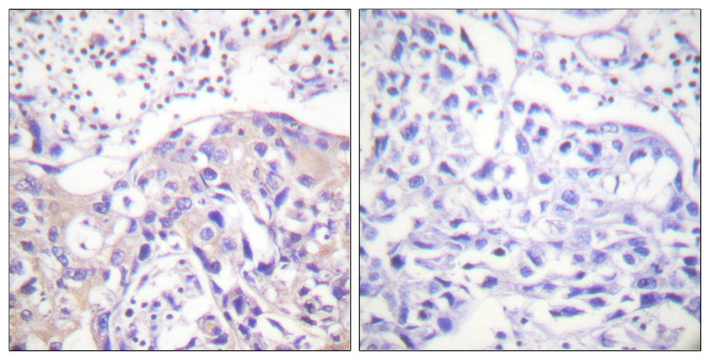 Adducin α (phospho Thr445) Rabbit Polyclonal Antibody