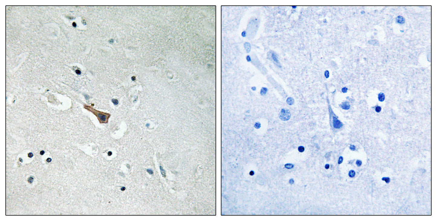 APLP2 (phospho Tyr755) Rabbit Polyclonal Antibody