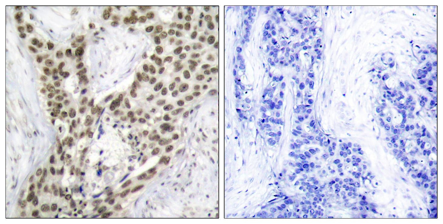 AR (phospho Ser213) Rabbit Polyclonal Antibody