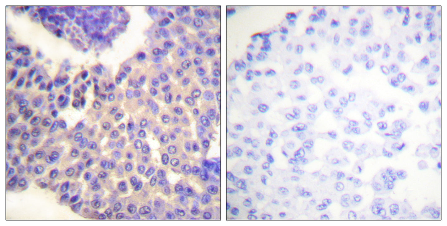Arrestin-β-1 (phospho Ser412) Rabbit Polyclonal Antibody