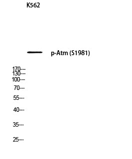 Atm (phospho Ser1981) Rabbit Polyclonal Antibody
