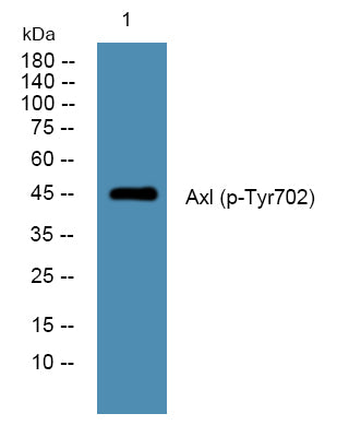 Axl (phospho-Tyr702) Rabbit Polyclonal Antibody