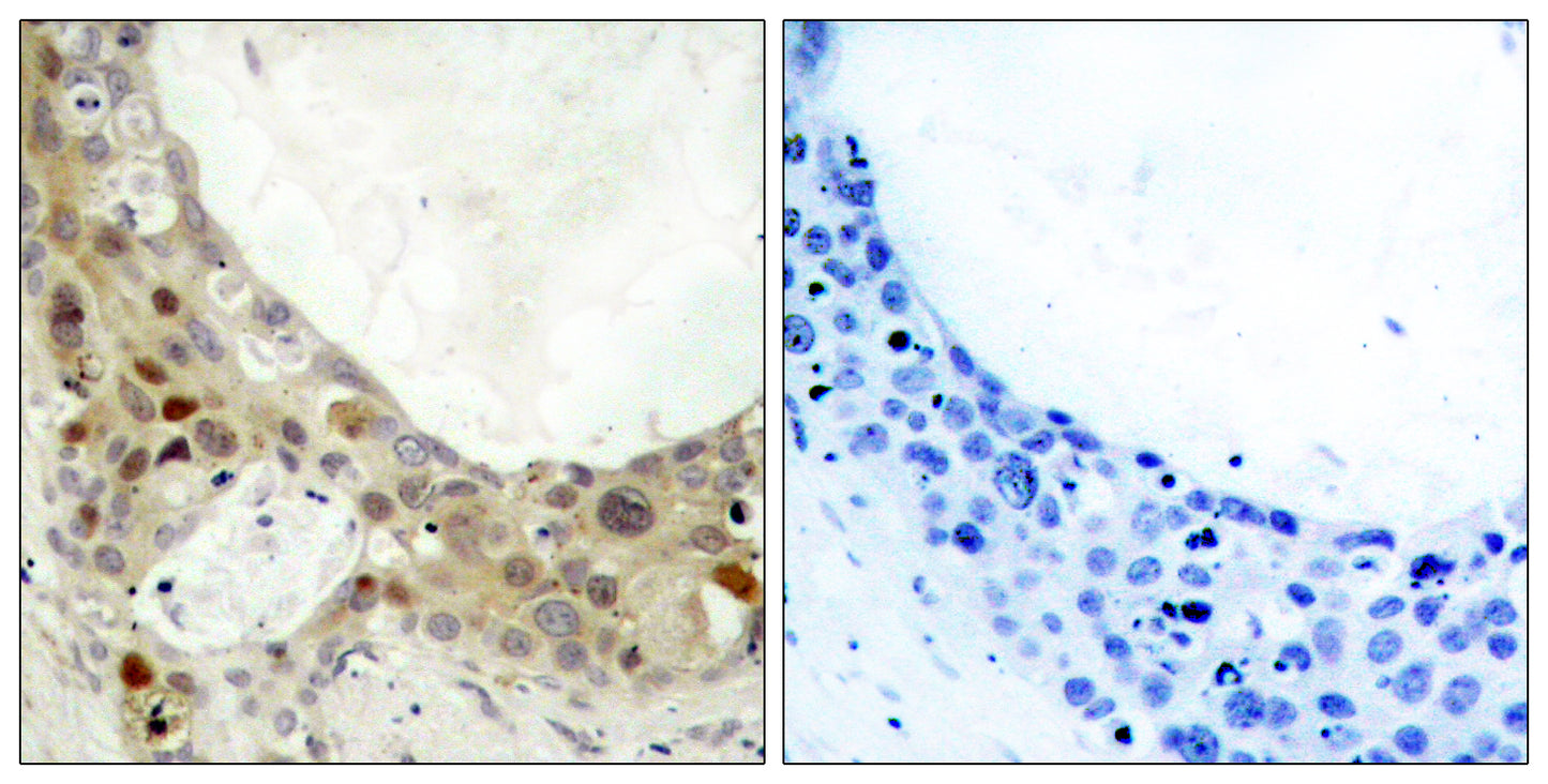 Bcl-2 (phospho Ser70) Rabbit Polyclonal Antibody