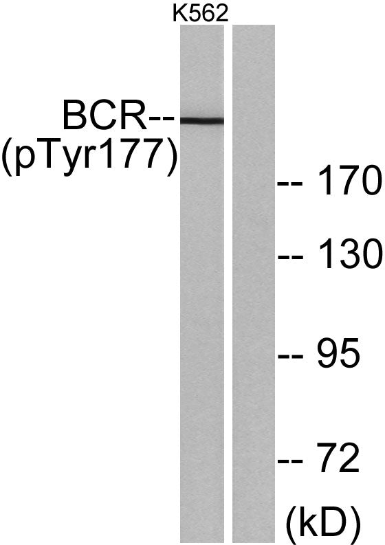 Bcr (phospho Tyr177) Rabbit Polyclonal Antibody