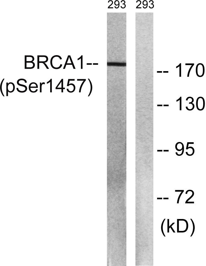 BRCA1 (phospho Ser1457) Rabbit Polyclonal Antibody