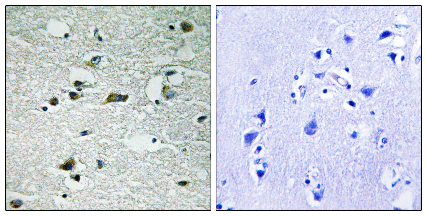 Casein Kinase Iγ1/2/3 (phospho Tyr263) Rabbit Polyclonal Antibody