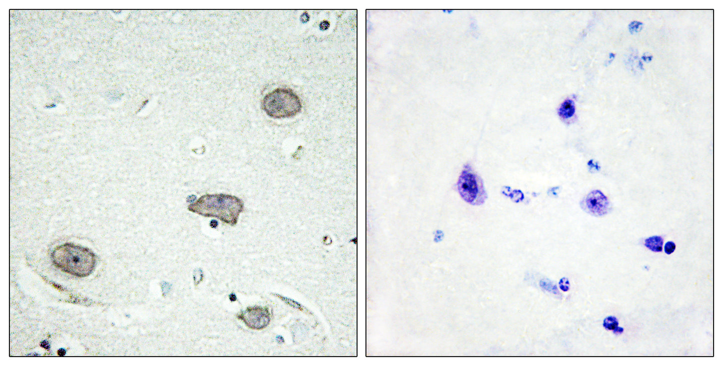 c-Fms (phospho Tyr809) Rabbit Polyclonal Antibody