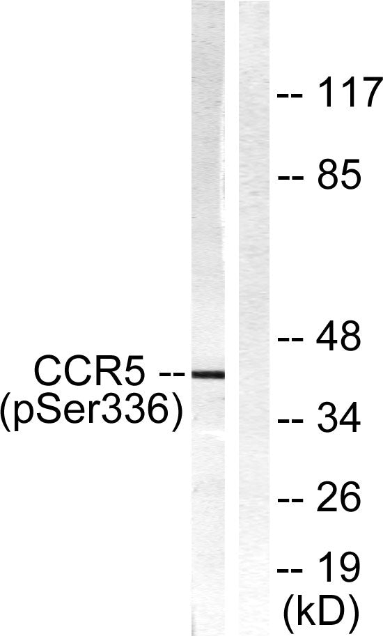 CKR-5 (phospho Ser336) Rabbit Polyclonal Antibody