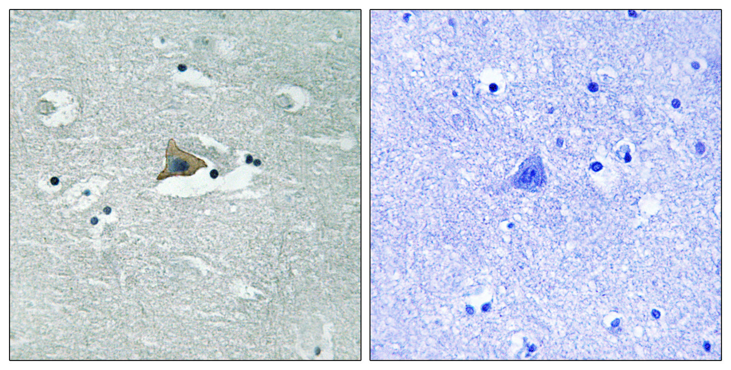 Claudin-5 (phospho Tyr217) Rabbit Polyclonal Antibody