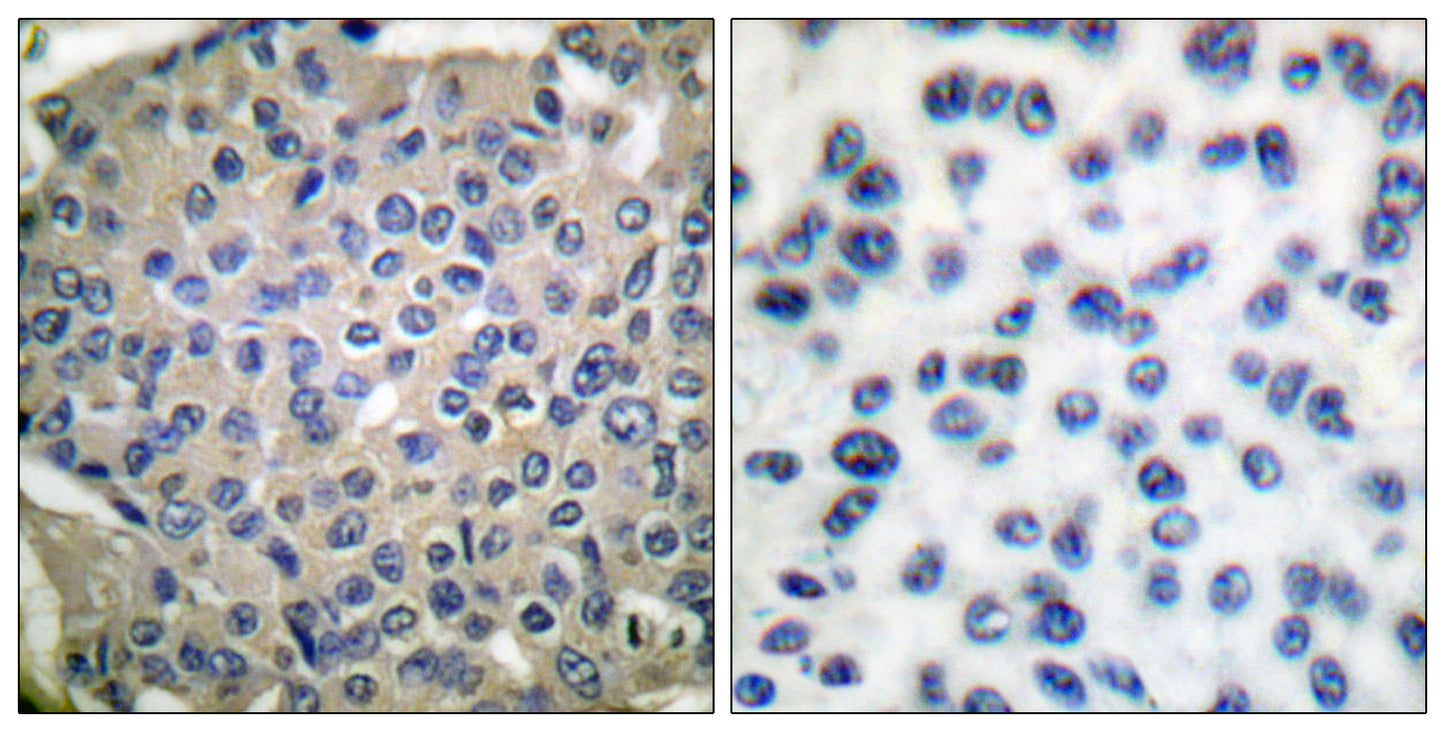 Cortactin (phospho Tyr466) Rabbit Polyclonal Antibody