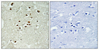 DNA Ligase IV (phospho Thr650) Rabbit Polyclonal Antibody