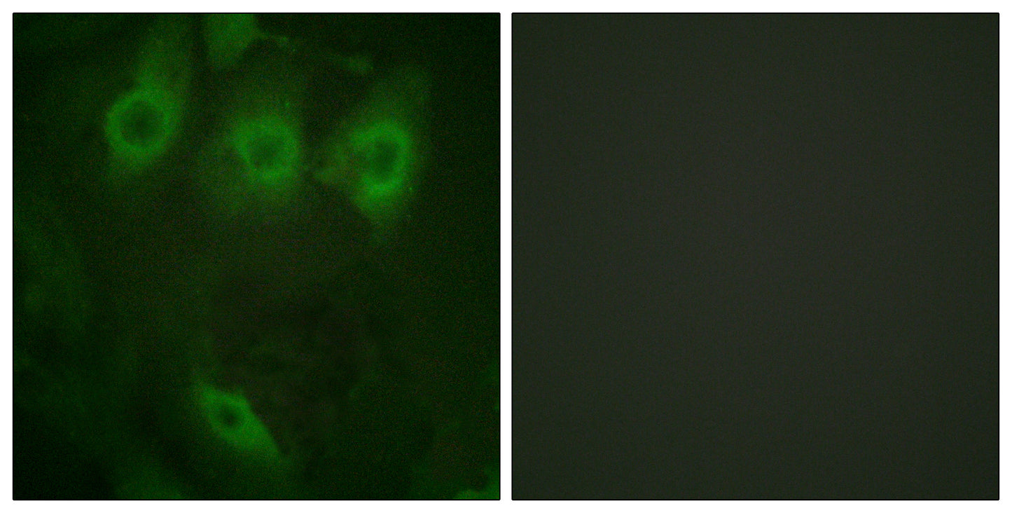 EGFR (phospho Tyr1016) Rabbit Polyclonal Antibody