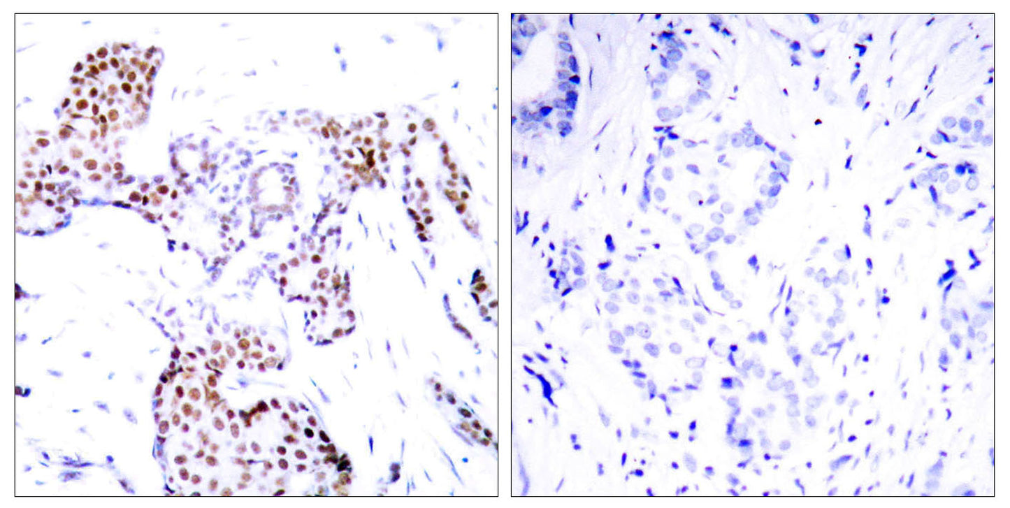 Elk-1 (phospho Ser389) Rabbit Polyclonal Antibody