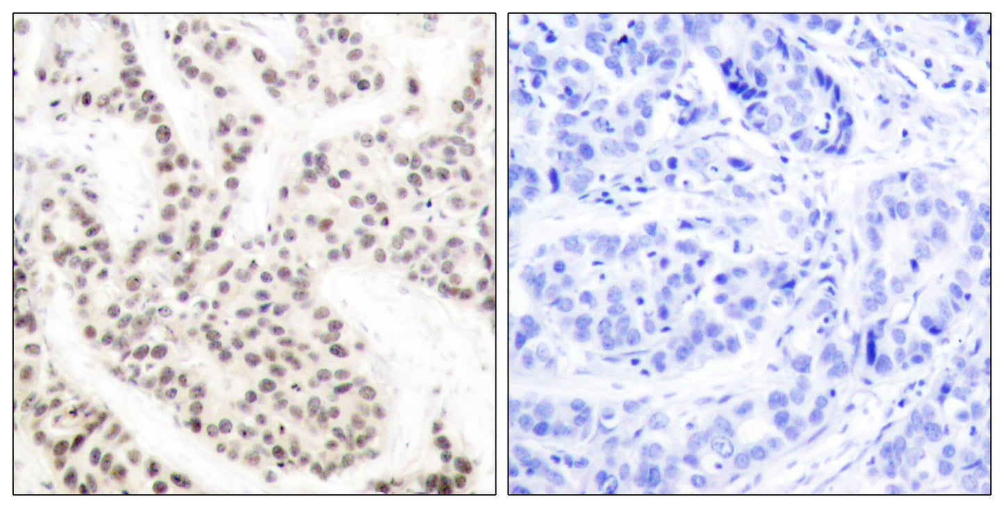 Elk-1 (phospho Thr417) Rabbit Polyclonal Antibody