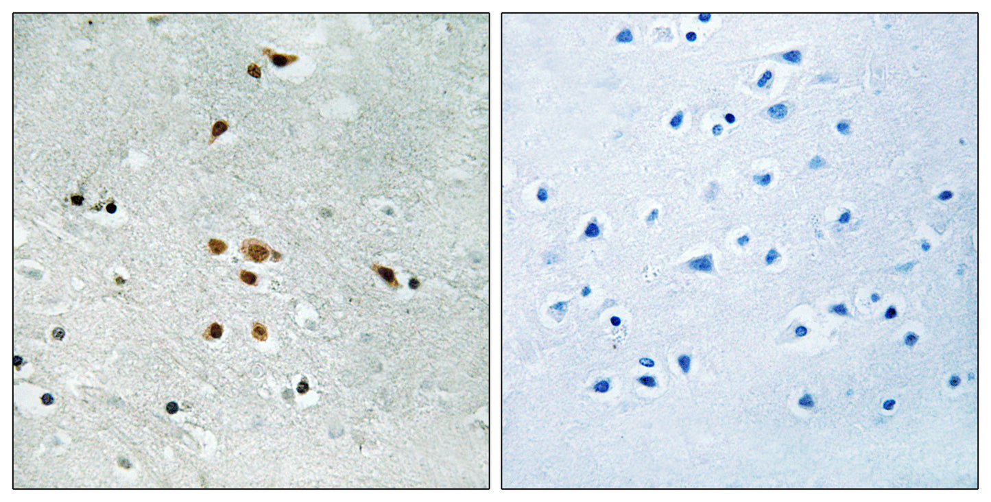 Fer (phospho Tyr402) Rabbit Polyclonal Antibody