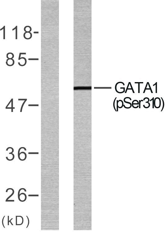 GATA-1 (phospho Ser310) Rabbit Polyclonal Antibody