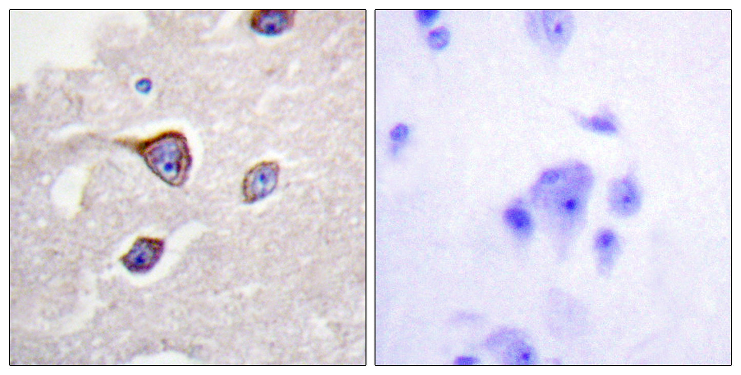 GRK 1 (phospho Ser21) Rabbit Polyclonal Antibody