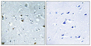 HMG-17 (phospho Ser29) Rabbit Polyclonal Antibody