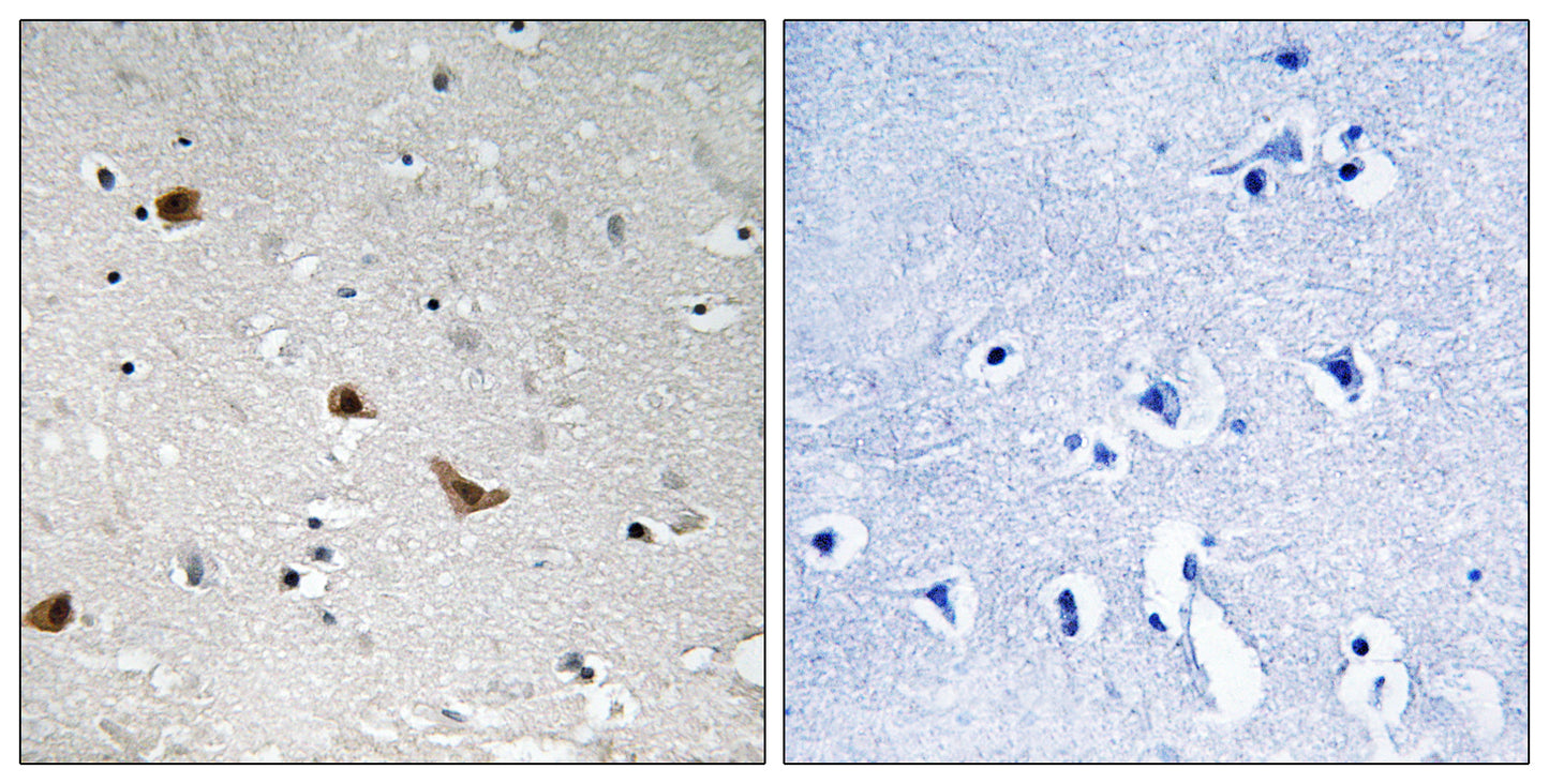 IKKγ (phospho Ser376) Rabbit Polyclonal Antibody