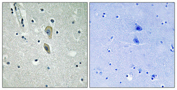 IL-1RI (phospho Tyr496) Rabbit Polyclonal Antibody