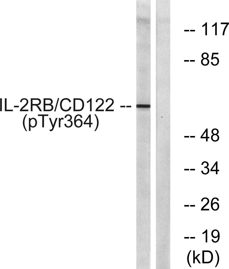 IL-2Rβ (phospho Tyr364) Rabbit Polyclonal Antibody