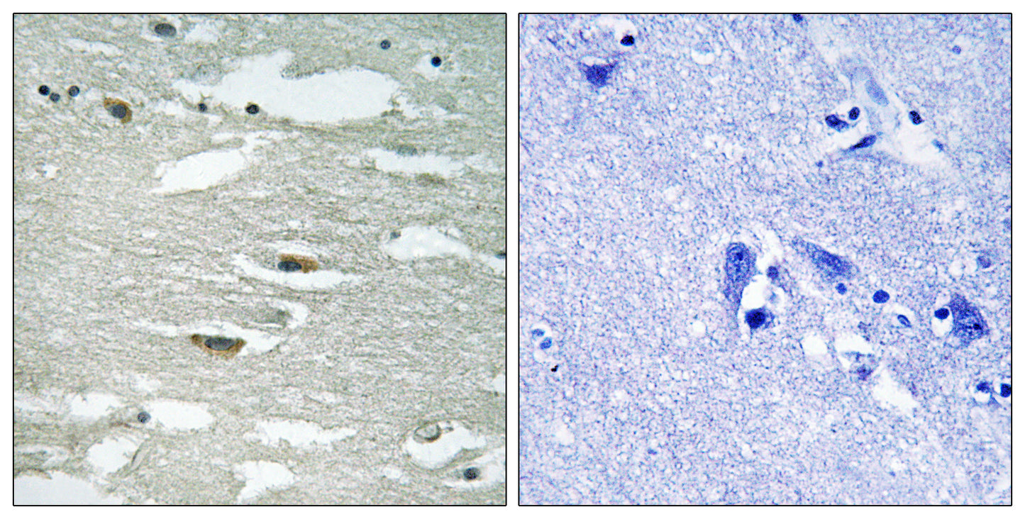 ILK (phospho Ser246) Rabbit Polyclonal Antibody