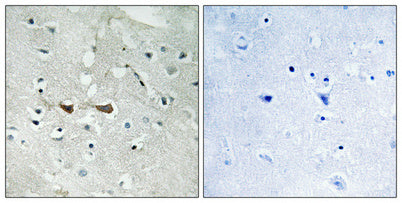 Integrin α4 (phospho Ser1027) Rabbit Polyclonal Antibody