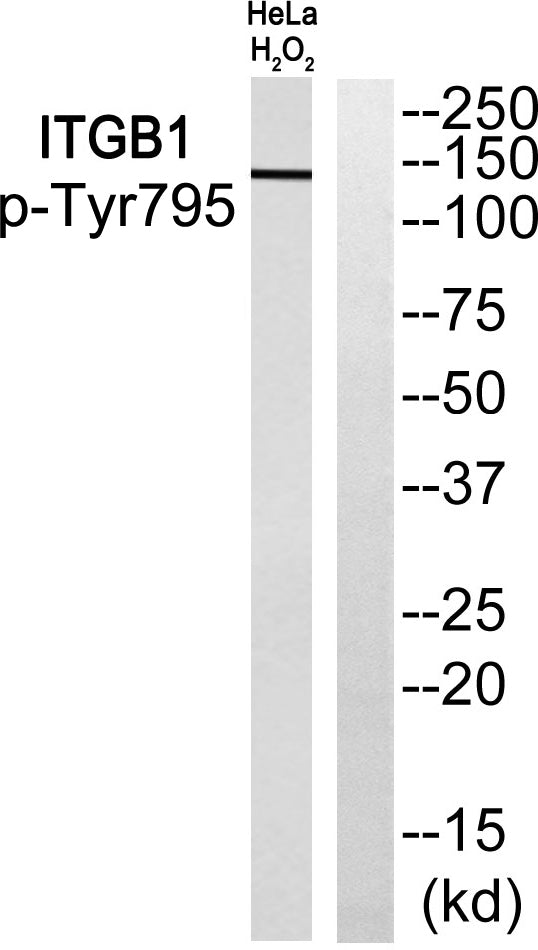 Integrin β1 (phospho Tyr795) Rabbit Polyclonal Antibody