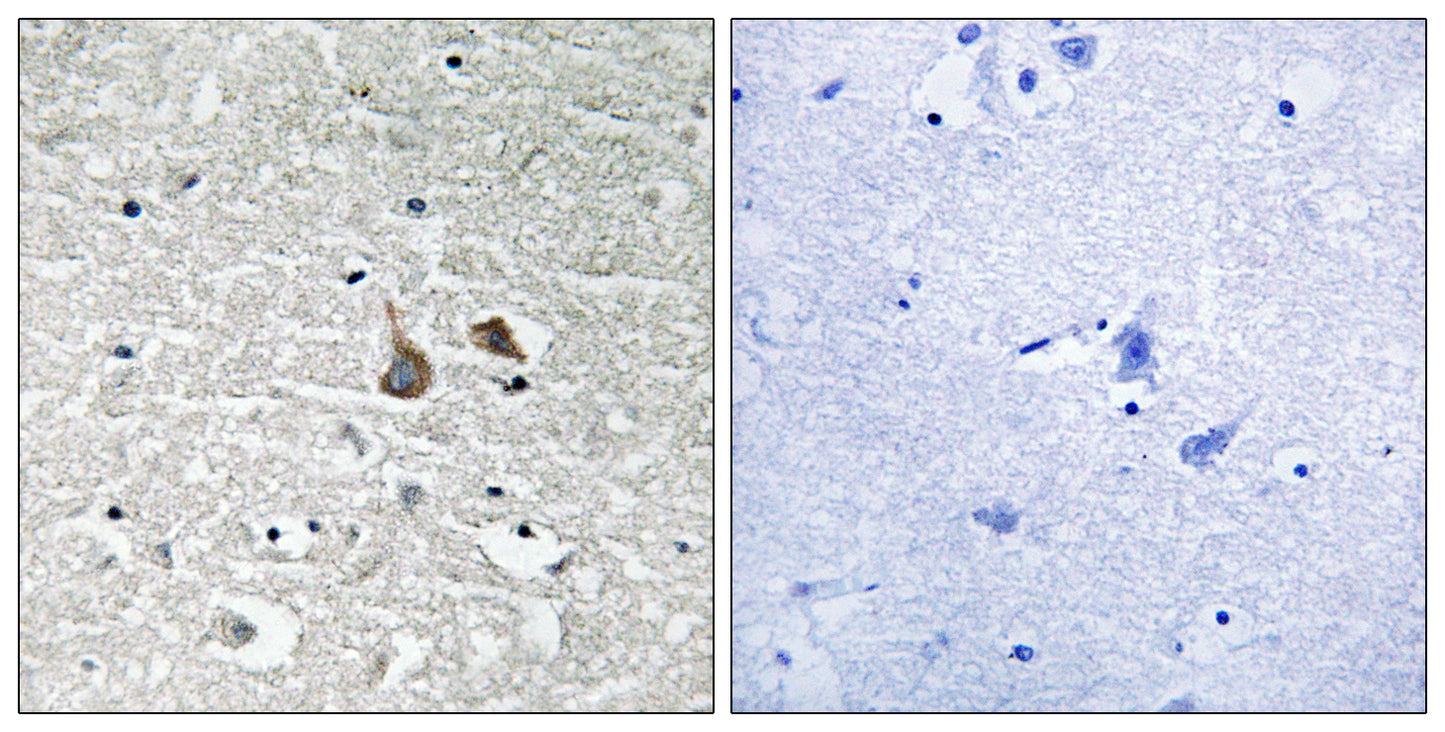 IRAK-1 (phospho Ser376) Rabbit Polyclonal Antibody