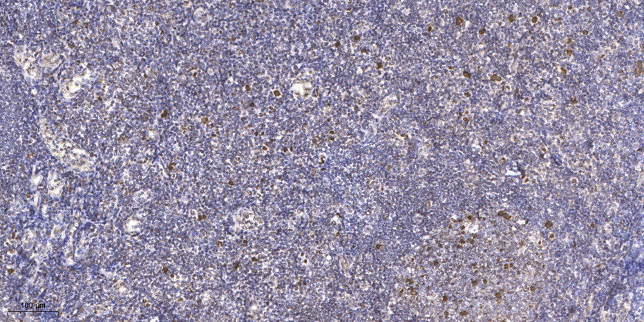 JDP2 (phospho Thr148) Rabbit Polyclonal Antibody