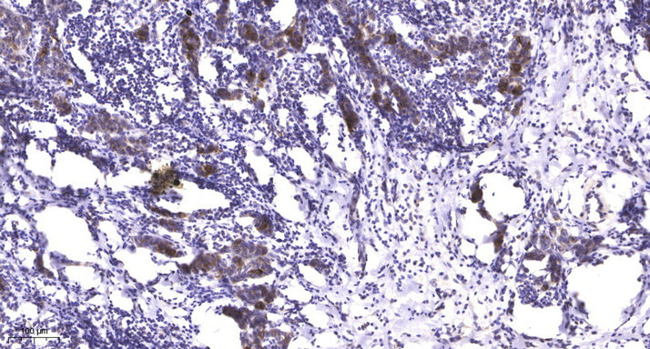 LATS1 (phospho-Ser909) Rabbit Polyclonal Antibody