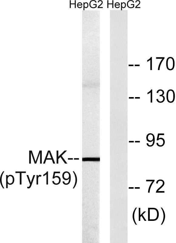 MAK (phospho Tyr159) Rabbit Polyclonal Antibody