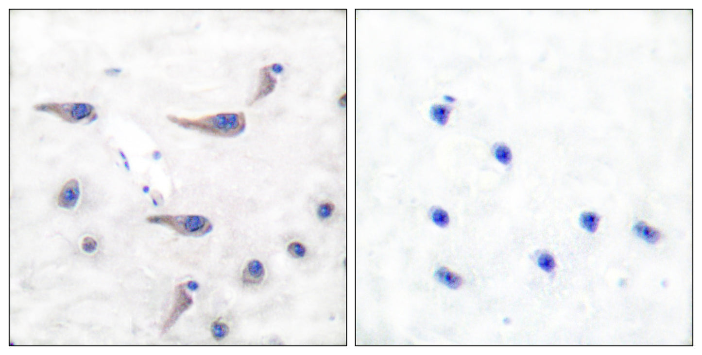 MARCKS (phospho Ser163) Rabbit Polyclonal Antibody